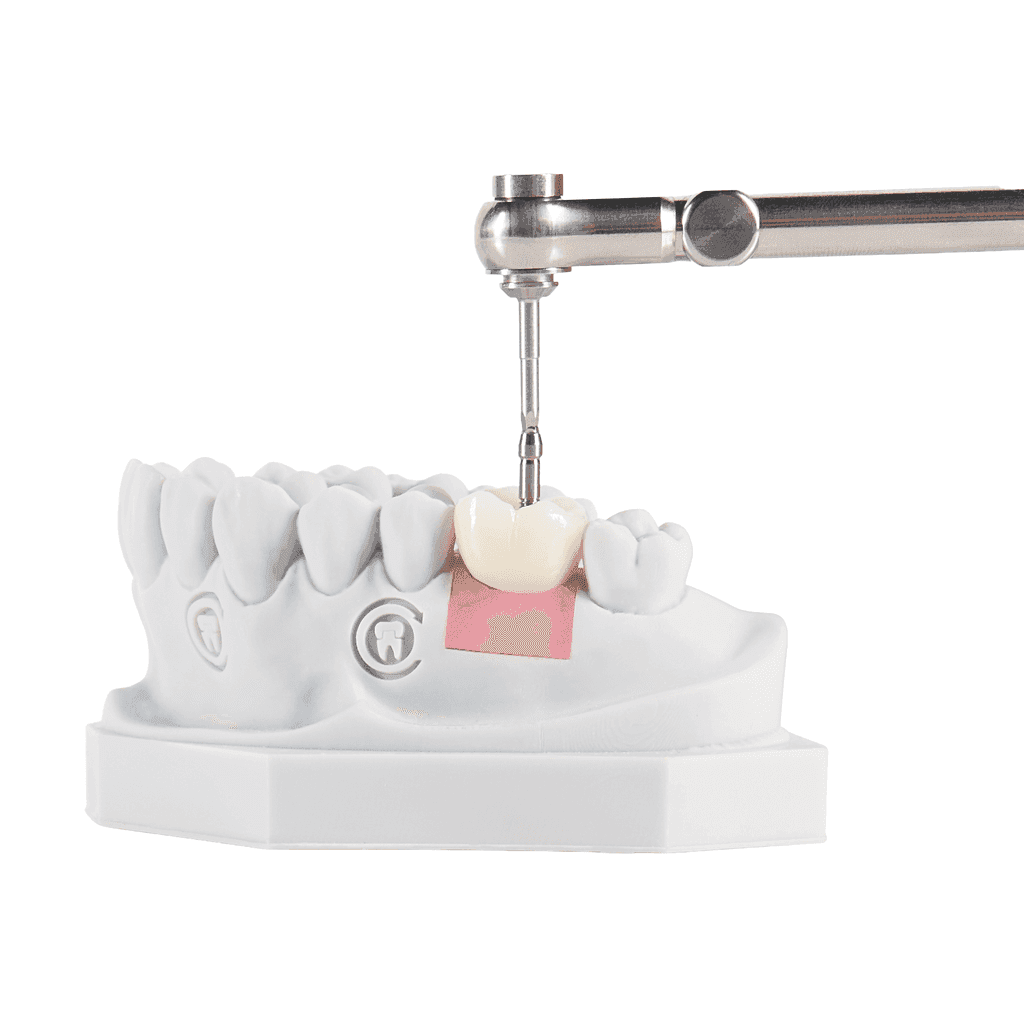 Screw-Retained gallery image 1
