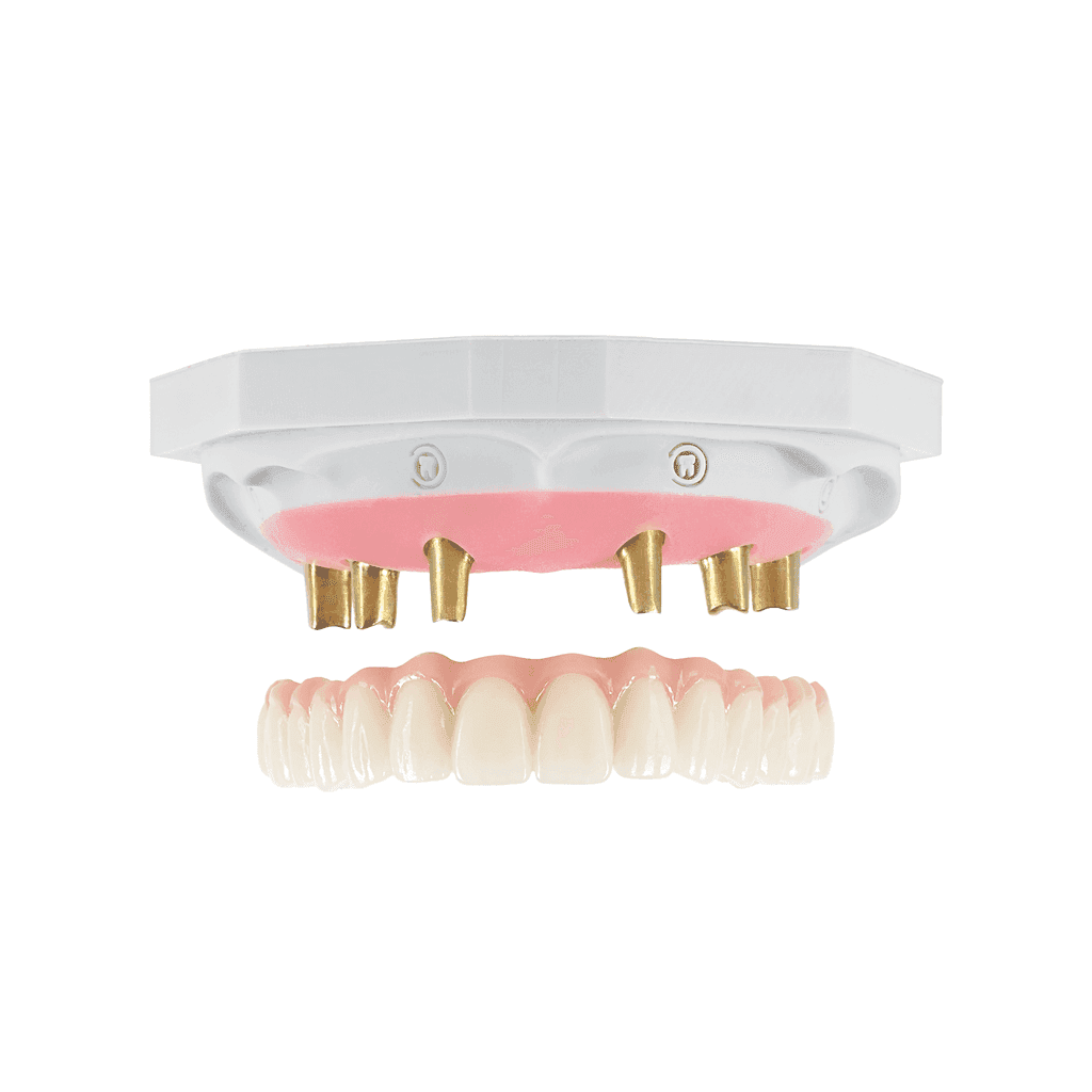 Screw-Retained gallery image 2
