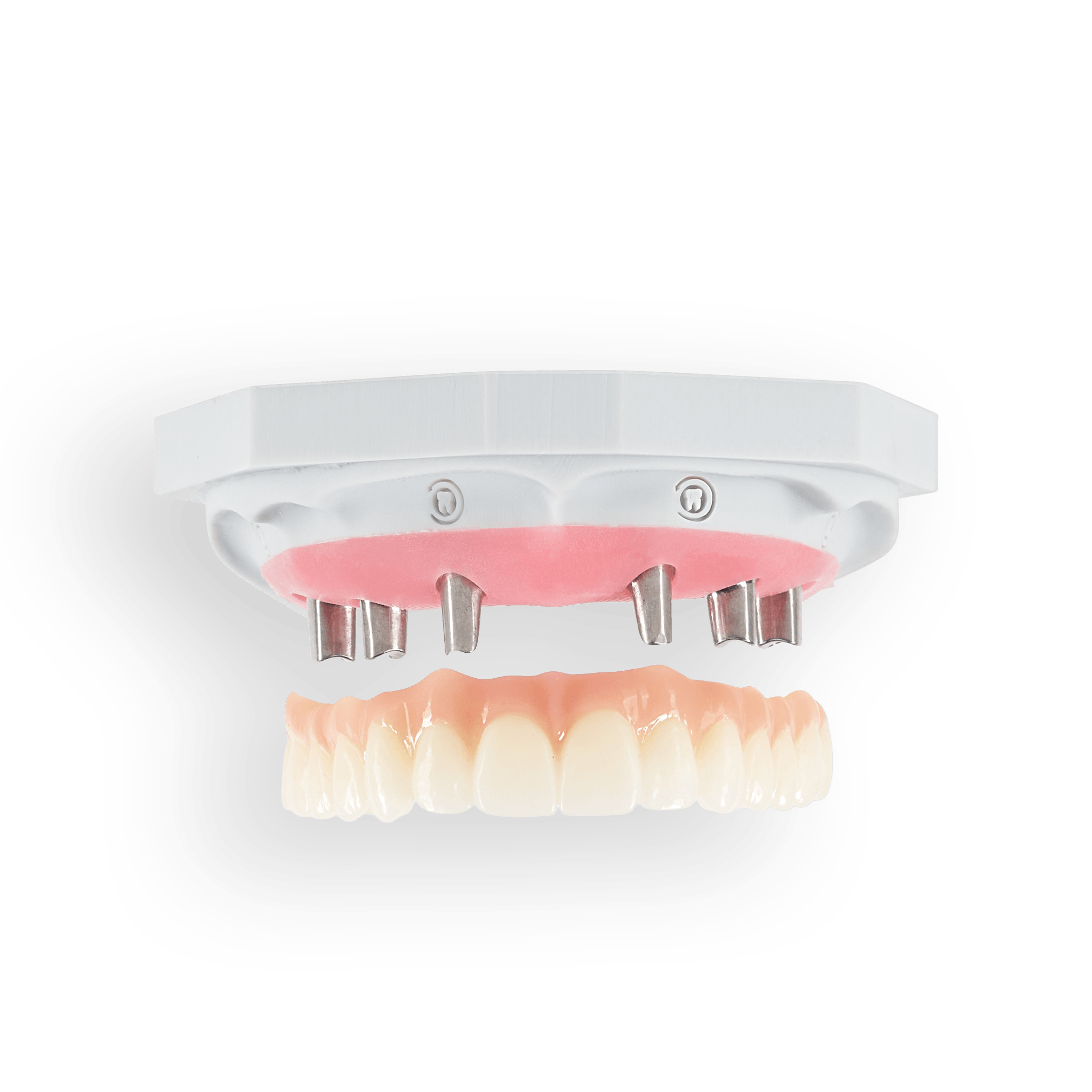 NeoSolidZir restoration