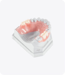 Complete Denture gallery image 2