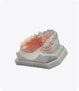 Partial Denture gallery image 3