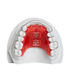 Essix Retainer gallery image 3