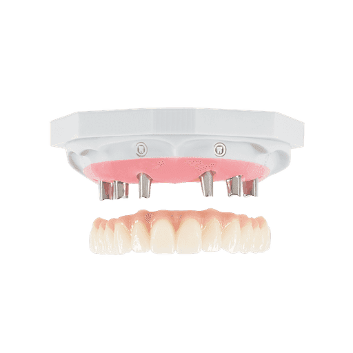 All-on-X full-arch implant