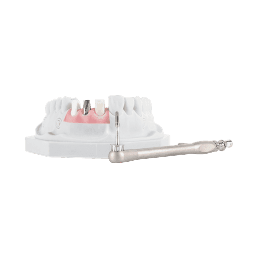 Implant-supported bridge