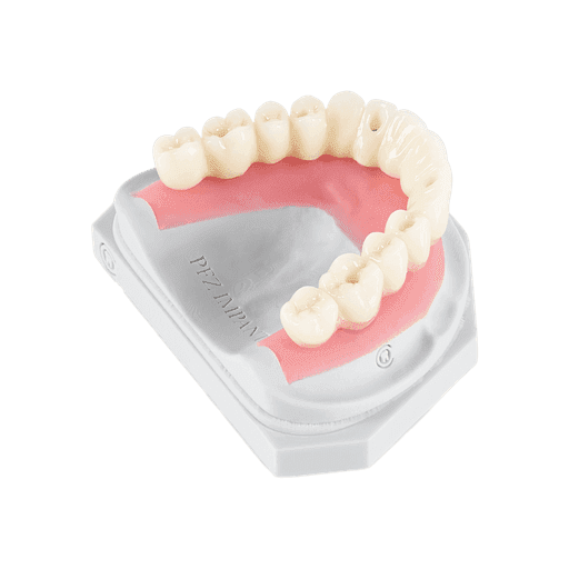 Screw Retained implant
