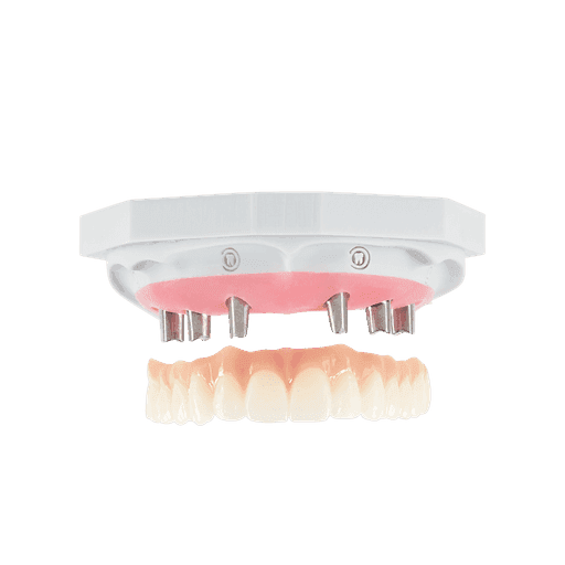 NeoSolidZir restoration