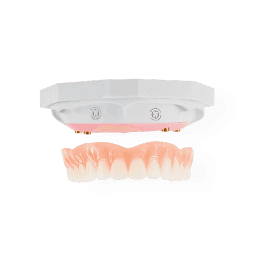 NeoSnap restoration